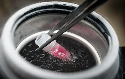 Stem Cell Treatment for Pain Bellingham, WA
