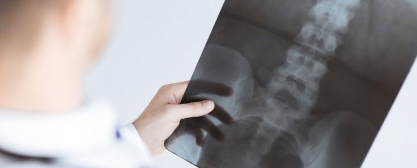 spine-and-extremity-x-rays-mount-vernon-wa Spine and Extremity X-rays Mount Vernon, WA